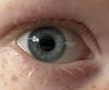Eyes: Photo 1 of 3