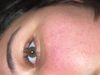 Eyelashes : Photo 1 of 1